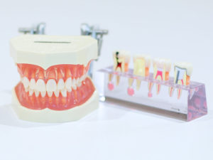 まちの歯科医院　小児歯科　で紹介している方法　その2