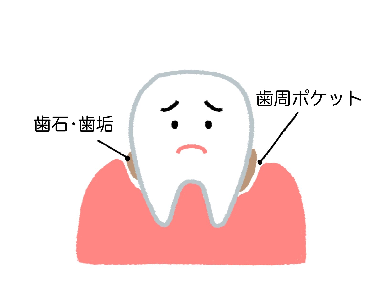 筑後　歯周病治療