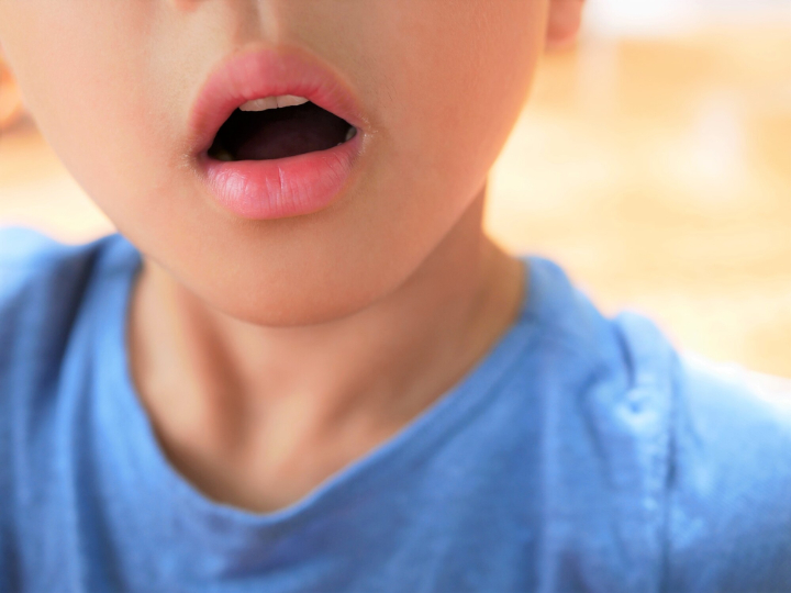 口を開けるのが癖になっている男の子