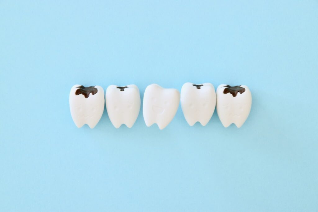 虫歯のイメージ