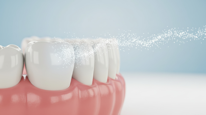 フッ素塗布のイメージ